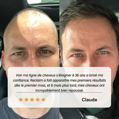 Reclaim – Sérum Repousse